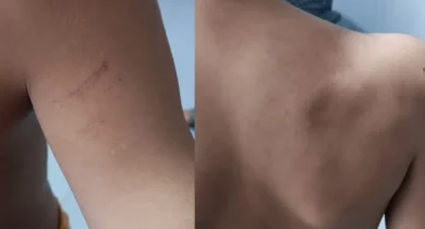 (Foto: Divulgação)