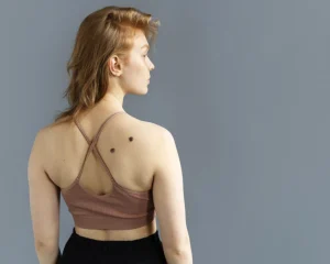 Câncer de pele representa 33% de todos os diagnósticos oncológicos Foto: Freepik