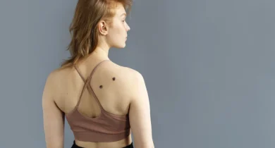 Câncer de pele representa 33% de todos os diagnósticos oncológicos Foto: Freepik