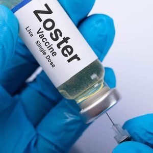 zoster